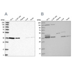 Anti-VTA1 Antibody
