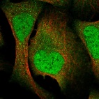 Immunofluorescent staining of human cell line U-2 OS shows localization to nucleoplasm, cytosol & vesicles.
