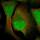 Immunofluorescent staining of human cell line U-2 OS shows localization to nucleoplasm, cytosol & vesicles.
