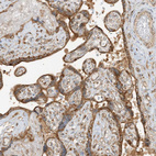 Anti-N4BP3 Antibody