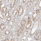 Anti-N4BP3 Antibody