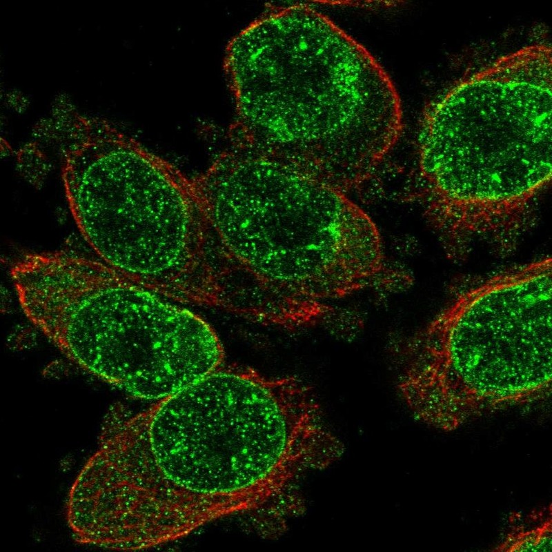 Anti-TRPM2 Antibody