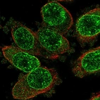 Anti-TRPM2 Antibody
