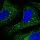 Anti-CREB3 Antibody