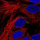 Immunofluorescent staining of human cell line CACO-2 shows localization to vesicles.