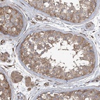 Anti-AGBL5 Antibody