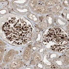Anti-PPM1F Antibody