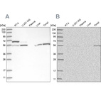 Western blot analysis using Anti-PPM1F antibody HPA030989 (A) shows similar pattern to independent antibody HPA030990 (B).