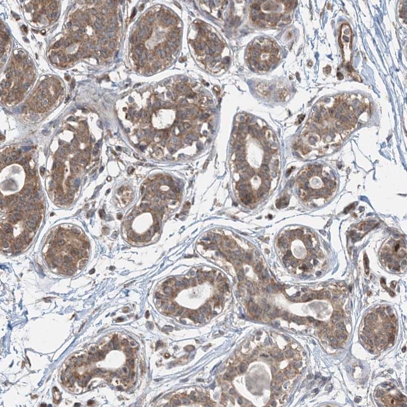 Anti-PPM1F Antibody