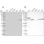 Western blot analysis using Anti-PPM1F antibody HPA030990 (A) shows similar pattern to independent antibody HPA030989 (B).