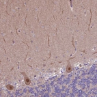 Immunohistochemical staining of human cerebellum shows weak cytoplasmic positivity and moderate nuclear positivity in Purkinje cells.