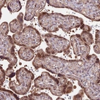 Immunohistochemical staining of human placenta shows moderate cytoplasmic positivity and strong nuclear positivity in trophoblastic cells.