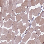 Immunohistochemical staining of human skeletal muscle shows weak cytoplasmic and nuclear positivity in myocytes.