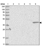 Lane 1: Marker [kDa] 230, 130, 95, 72, 56, 36, 28, 17, 11_br/_Lane 2: Human cell line RT-4_br/_Lane 3: Human cell line U-251MG sp_br/_Lane 4: Human plasma (IgG/HSA depleted)_br/_Lane 5: Human liver tissue_br/_Lane 6: Human tonsil tissue