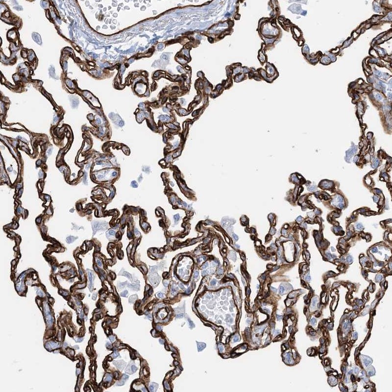 Anti-EPS8L3 Antibody