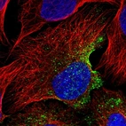 Immunofluorescent staining of human cell line U-2 OS shows localization to vesicles.
