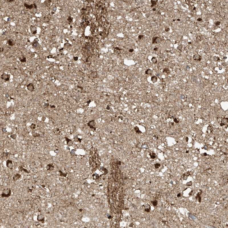 Anti-TAGAP Antibody