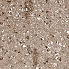 Anti-TAGAP Antibody