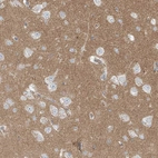 Anti-LZTS3 Antibody