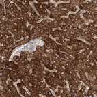 Anti-LZTS3 Antibody