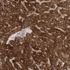 Anti-LZTS3 Antibody