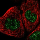 Immunofluorescent staining of human cell line A-431 shows localization to nucleoplasm.