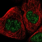 Immunofluorescent staining of human cell line A-431 shows localization to nucleoplasm.