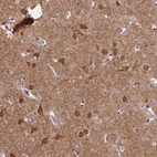 Anti-PTPN5 Antibody