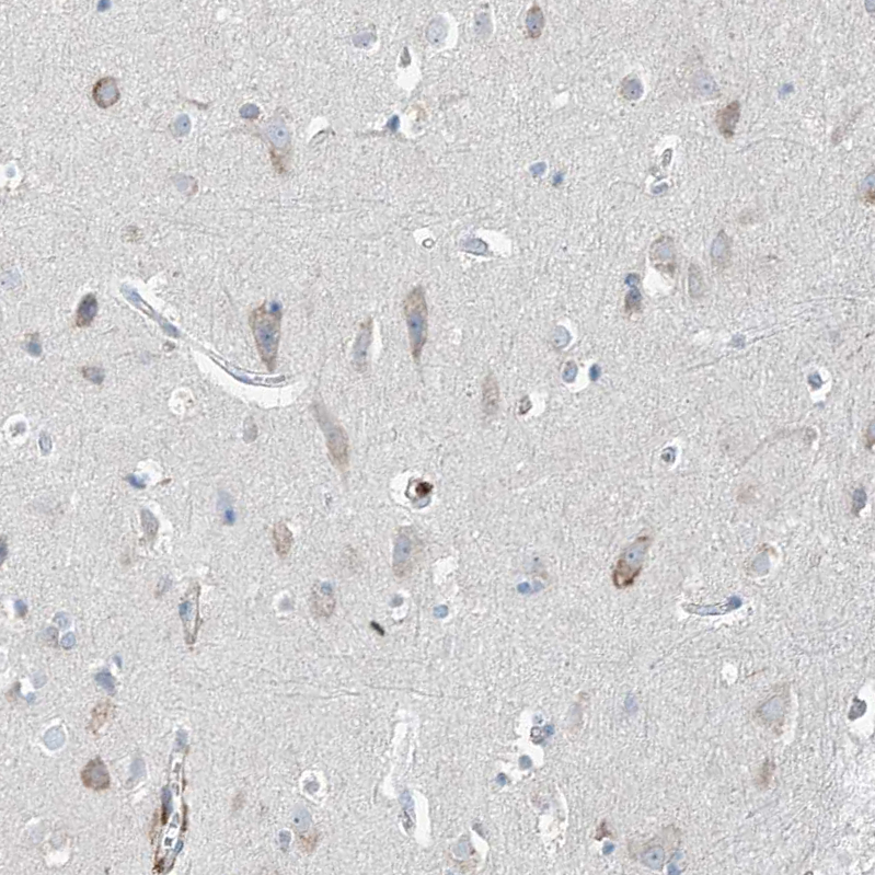 Anti-GALNTL6 Antibody