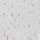 Anti-GALNTL6 Antibody