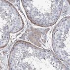 Immunohistochemical staining of human testis shows strong cytoplasmic positivity in Leydig cells.