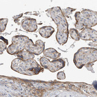Immunohistochemical staining of human placenta shows strong cytoplasmic positivity in trophoblastic cells.
