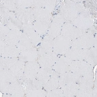 Immunohistochemical staining of human skeletal muscle shows no positivity in myocytes as expected.