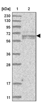 Lane 1: Marker [kDa] 230, 130, 95, 72, 56, 36, 28, 17, 11_br/_Lane 2: Human cell line RT-4
