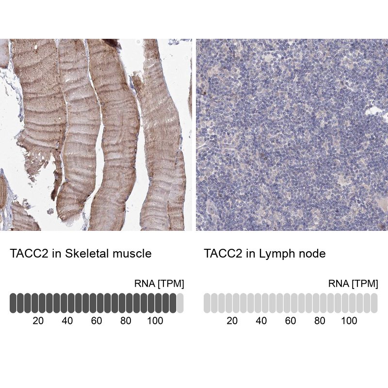 Anti-TACC2 Antibody