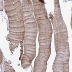 Immunohistochemical staining of human skeletal muscle shows high expression.