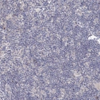 Immunohistochemical staining of human lymph node shows low expression as expected.