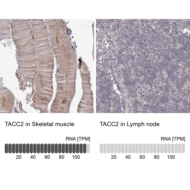 Anti-TACC2 Antibody