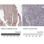 Anti-TACC2 Antibody