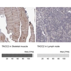Anti-TACC2 Antibody