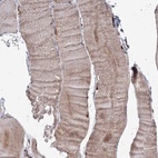Immunohistochemical staining of human skeletal muscle shows high expression.