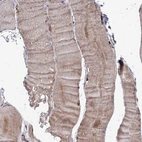 Immunohistochemical staining of human skeletal muscle shows high expression.