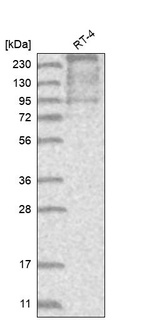 Western blot analysis in human cell line RT-4.