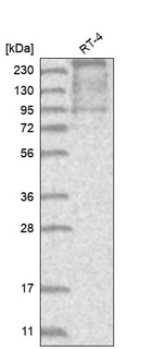 Western blot analysis in human cell line RT-4.