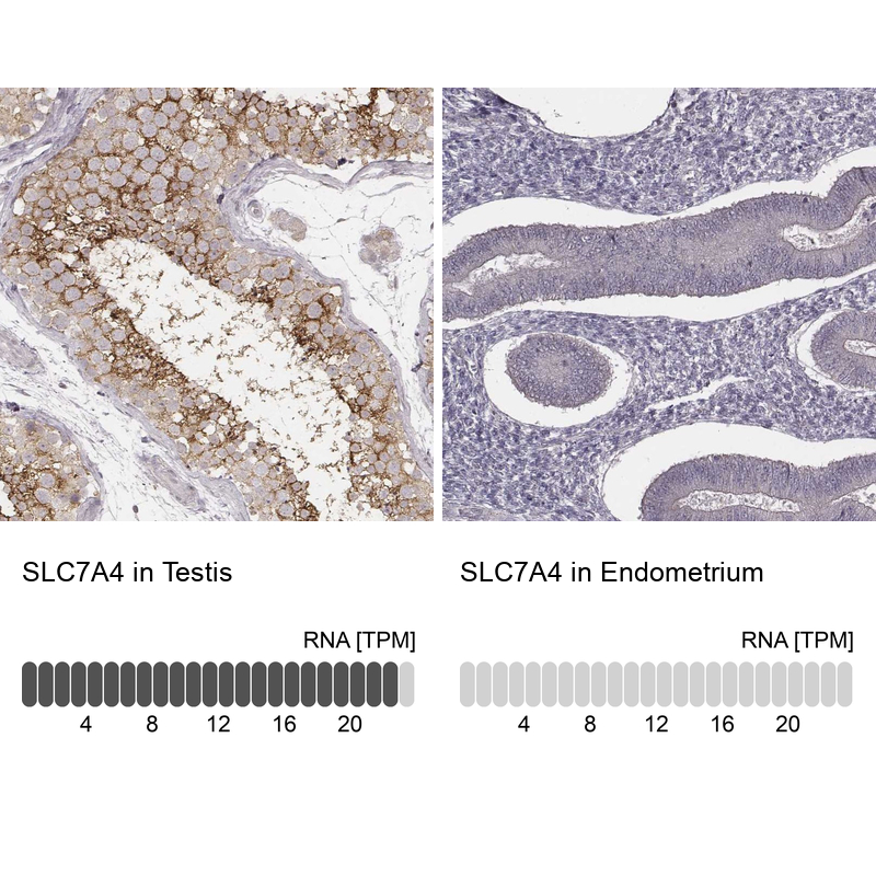 Anti-SLC7A4 Antibody
