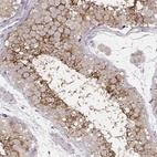 Immunohistochemical staining of human testis shows high expression.