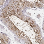 Immunohistochemical staining of human testis shows high expression.