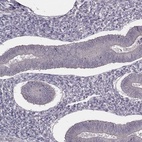 Immunohistochemical staining of human endometrium shows low expression as expected.
