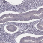 Immunohistochemical staining of human endometrium shows low expression as expected.