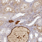 Immunohistochemical staining of human kidney shows strong positivity in plasma.